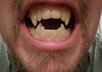 email you detailed instructions to make professional prosthetic teeth that do not require adhesive small2