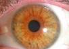 give you an iridology reading with written information about your eyes health patterns small3