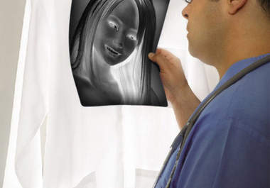 send you a picture of doctor holding your xray film big3