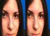 make your five photos wrinkle or acne free using photoshop small1