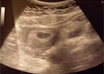 create a Custom Baby Name List