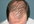 tell you how to prevent balding, stop hair loss and let your hair grow again