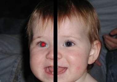 fix and remove red eye in 10 photos photographs big1