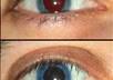 remove red eye effect in up to 3 photos small1