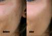 remove wrinkles or blemishes from 2 photos