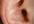 tell you how to treat severe ear pain with a simple remerdy you can get