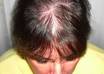 stop your hair loss, help grow hair